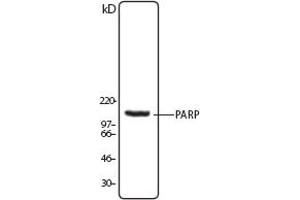 Image no. 1 for anti-Poly (ADP-Ribose) Polymerase 1 (PARP1) (N-Term) antibody (ABIN307559) (PARP1 antibody  (N-Term))