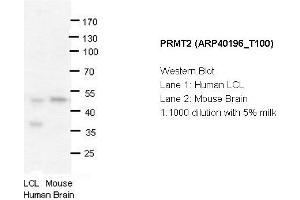 Image no. 1 for anti-Protein Arginine Methyltransferase 2 (PRMT2) (N-Term) antibody (ABIN2778663) (PRMT2 antibody  (N-Term))