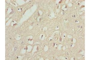 Immunohistochemistry of paraffin-embedded human brain tissue using ABIN7159778 at dilution of 1:100 (MAP1LC3A antibody  (AA 1-120))