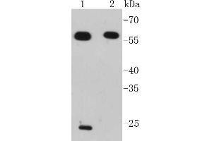 Lane 1: Jurkat, Lane 2: Raji lysates probed with IRF7 (2A1) Monoclonal Antibody  at 1:1000 overnight at 4˚C. (IRF7 antibody)