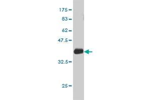 Western Blot detection against Immunogen (36. (Deoxyuridine Triphosphatase (DUT) (AA 68-164) antibody)