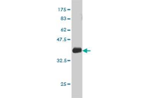 Deoxyuridine Triphosphatase (DUT) (AA 68-164) antibody