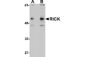 Western Blotting (WB) image for anti-Receptor-Interacting Serine-threonine Kinase 2 (RIPK2) (C-Term) antibody (ABIN1030619) (RIPK2 antibody  (C-Term))