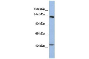 SLIT1 antibody used at 1 ug/ml to detect target protein. (SLIT1 antibody)