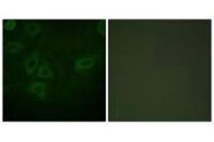 Immunofluorescence analysis of HepG2 cells, using TK (Ab-13) antibody. (TK1 antibody  (Ser13))