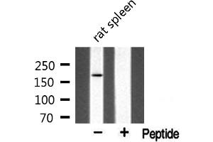 Western blot analysis of extracts from rat spleen, using MLH3 antibody.
