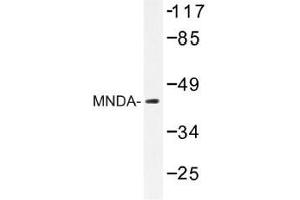 Image no. 1 for anti-Myeloid Cell Nuclear Differentiation Antigen (MNDA) antibody (ABIN317919) (MNDA antibody)