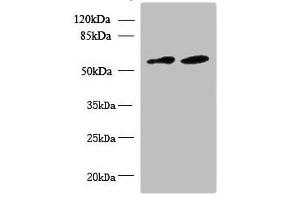 Western blot All lanes: KBTBD4 antibody at 10 μg/mL Lane 1: U87 whole cell lysate Lane 2: NIH/3T3 whole cell lysate Secondary Goat polyclonal to rabbit IgG at 1/10000 dilution Predicted band size: 59, 60 kDa Observed band size: 59 kDa (KBTBD4 antibody  (AA 151-415))