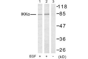 Image no. 2 for anti-conserved Helix-Loop-Helix Ubiquitous Kinase (CHUK) (Thr23) antibody (ABIN197306) (IKK alpha antibody  (Thr23))