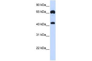 WB Suggested Anti-GUCY1B3 Antibody Titration:  0.