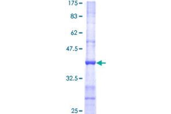 POMT2 Protein (AA 483-580) (GST tag)