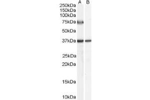 Image no. 1 for anti-Acyl-CoA Oxidase 2, Branched Chain (Acox2) (C-Term), (Internal Region) antibody (ABIN374845)