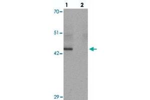 Western blot analysis of KLF4 in mouse liver tissue with KLF4 monoclonal antibody, clone 4E5C3  at 1 ug/mL in (lane 1) the absence and (lane 2) the presence of blocking peptide. (KLF4 antibody  (C-Term))