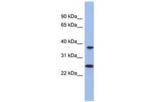 Image no. 1 for anti-Mitochondrial Translational Release Factor 1-Like (MTRF1L) (N-Term) antibody (ABIN6743271)