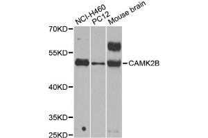 Western blot analysis of extracts of various cell lines, using CAMK2B antibody (ABIN1871413) at 1:1000 dilution. (CAMK2B antibody)
