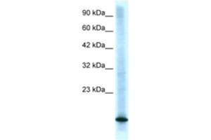 Western Blotting (WB) image for anti-Cyclin-Dependent Kinase Inhibitor 2B (p15, Inhibits CDK4) (CDKN2B) antibody (ABIN2463682) (CDKN2B antibody)
