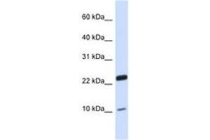 TAF13 antibody  (N-Term)