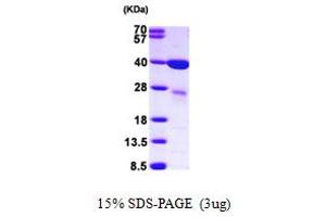 SDS-PAGE (SDS) image for Lectin, Galactoside-Binding, Soluble, 8 (LGALS8) (AA 1-317) (Active) protein (His tag) (ABIN667193)