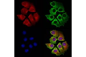 ABIN6263909 and ABIN6272972 staining Hela cells by IF/ICC. (OSBP antibody  (Internal Region))