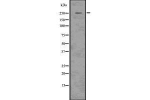 Western blot analysis of Aggrecan using 293 whole cell lysates