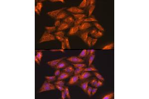 Immunofluorescence analysis of U-2 OS cells using IKKγ Rabbit pAb (ABIN3021150, ABIN3021151, ABIN3021152 and ABIN6214025) at dilution of 1:100 (40x lens). (IKBKG antibody  (AA 1-419))