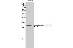 Western Blotting (WB) image for anti-Ephrin B1 (EFNB1) (pTyr317) antibody (ABIN3182253) (Ephrin B1 antibody  (pTyr317))