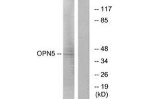 Western Blotting (WB) image for anti-Opsin 5 (OPN5) (AA 251-300) antibody (ABIN2890954)