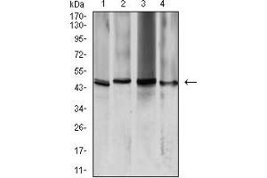 Western blot analysis using AQP2 mouse mAb against K562 (1), HeLa (2), HCT116 (3), and SW480 (4) cell lysate. (AQP2 antibody  (AA 149-271))
