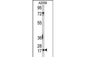 Western blot analysis of anti-UBE2I Antibody (N-term) (ABIN387910 and ABIN2844306) in  cell line lysates (35 μg/lane). (UBE2I antibody  (N-Term))