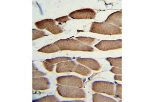 Formalin-fixed and paraffin-embedded human skeletal muscle with WNT5B Antibody (Center), which was peroxidase-conjugated to the secondary antibody, followed by DAB staining. (WNT5B antibody  (AA 153-182))