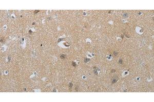 Immunohistochemistry of paraffin-embedded Human brain tissue using NPR1 Polyclonal Antibody at dilution of 1:30 (NPR1 antibody)