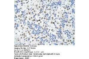 Rabbit Anti-HNRPA1 Antibody  Paraffin Embedded Tissue: Human Liver Cellular Data: Hepatocytes Antibody Concentration: 4. (HNRNPA1 antibody  (N-Term))