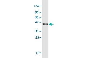 Western Blot detection against Immunogen (36. (PRKCDBP antibody  (AA 161-261))