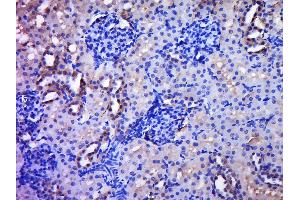 Paraformaldehyde-fixed, paraffin embedded rat kidney, Antigen retrieval by boiling in sodium citrate buffer (pH6. (C20ORF96 antibody  (AA 101-200))