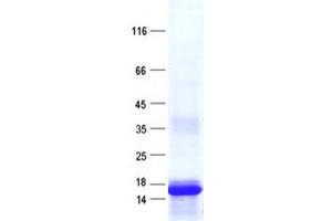 Validation with Western Blot (NUDT8 Protein (His tag))