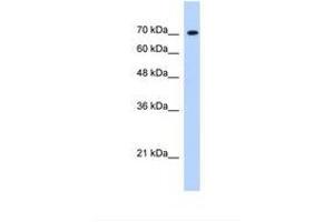 Image no. 1 for anti-Lysine (K)-Specific Demethylase 6B (Kdm6b) (AA 1613-1662) antibody (ABIN320516) (Kdm6b antibody  (AA 1613-1662))