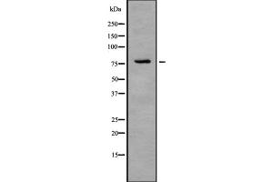 Western blot analysis IL-1R9 using COLO205 whole cell lysates (IL1RAPL2 antibody  (Internal Region))