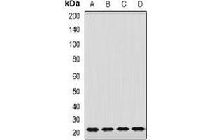 Western blot analysis of GrpEL2 expression in K562 (A), MCF7 (B), mouse brain (C), mouse lung (D) whole cell lysates. (GRPEL2 antibody)