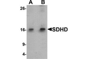 Western blot analysis of SDHD in EL4 cell lysate with SDHD antibody at (A) 1 and (B) 2 ug/mL.