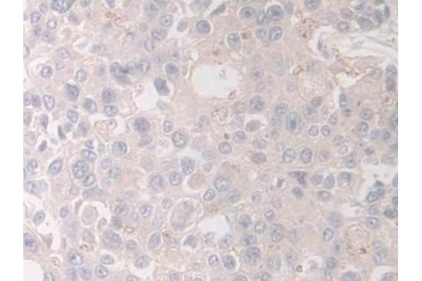 HPS4 antibody  (AA 6-192)