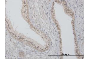 Immunoperoxidase of purified MaxPab antibody to FLOT2 on formalin-fixed paraffin-embedded human prostate. (Flotillin 2 antibody  (AA 1-379))