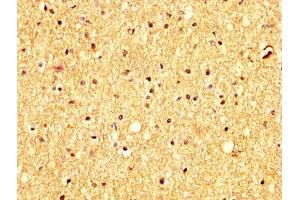 IHC image of ABIN7144013 diluted at 1:300 and staining in paraffin-embedded human brain tissue performed on a Leica BondTM system. (RHCG antibody  (AA 416-479))