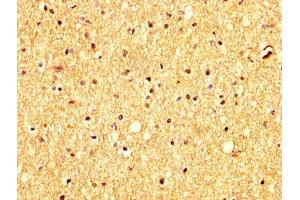 IHC image of ABIN7144013 diluted at 1:300 and staining in paraffin-embedded human brain tissue performed on a Leica BondTM system.