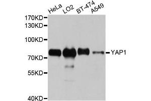 Western blot analysis of extracts of various cell lines, using YAP1 antibody. (YAP1 antibody)