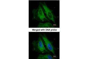 ICC/IF Image Immunofluorescence analysis of paraformaldehyde-fixed HeLa, using NOD1, antibody at 1:200 dilution. (NOD1 antibody  (C-Term))