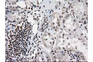Immunohistochemical staining of paraffin-embedded Human Kidney tissue using anti-PRKCE mouse monoclonal antibody. (PKC epsilon antibody)