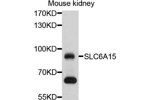 Western blot analysis of extracts of mouse kidney, using SLC6A15 antibody (ABIN4905212) at 1:1000 dilution.