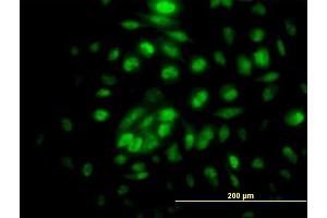 Immunofluorescence of purified MaxPab antibody to RPA4 on HeLa cell. (RPA4 antibody  (AA 1-261))
