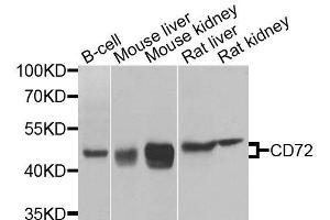 Western blot analysis of extracts of various cell lines, using CD72 antibody (ABIN6003638) at 1/1000 dilution. (CD72 antibody)