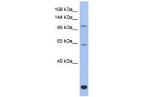Image no. 1 for anti-BTB and CNC Homology 1, Basic Leucine Zipper Transcription Factor 2 (BACH2) (C-Term) antibody (ABIN6742357) (BACH2 antibody  (C-Term))